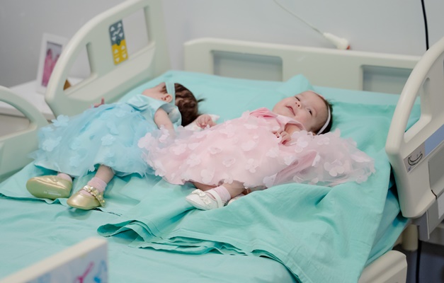 Gêmeas siamesas de Manaus recebem alta após 107 dias de internação