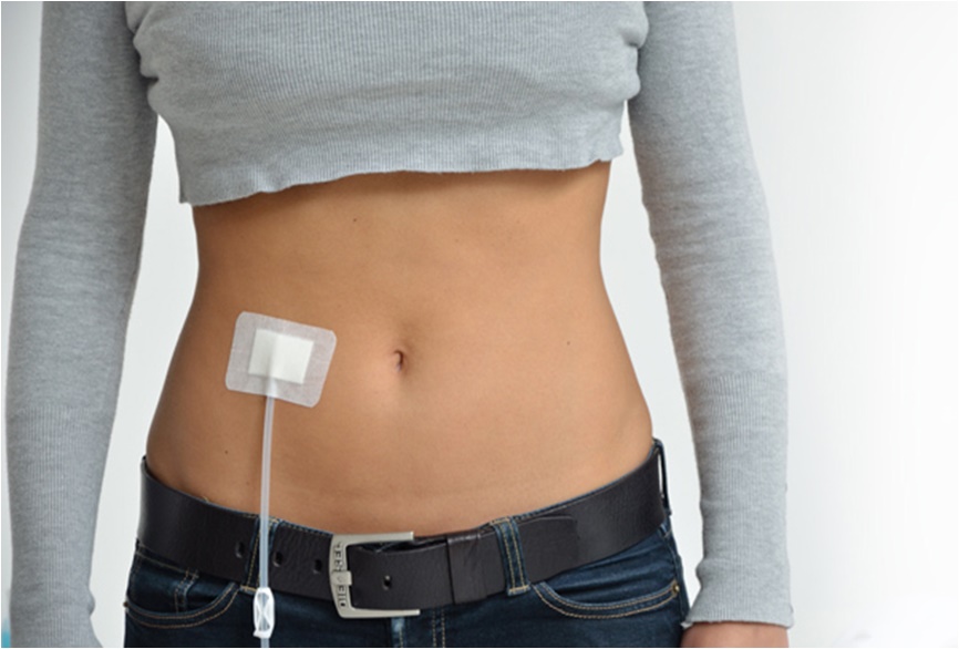 Goiás amplia atendimento a pacientes renais do SUS com serviço de diálise  