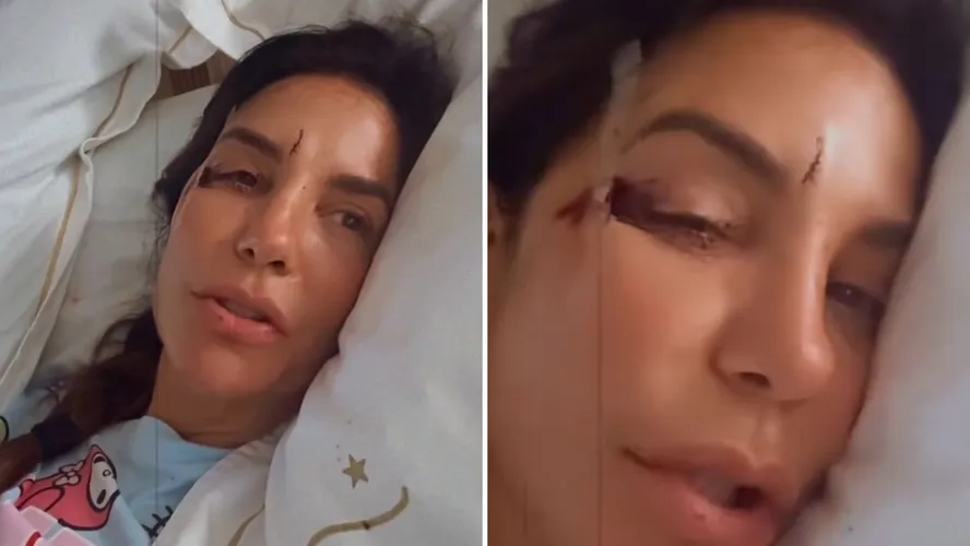 Ivete Sangalo é internada em Salvador após desmaio em casa